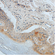 Anti HE4 mouse monoclonal antibody