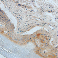 Anti HE4 mouse monoclonal antibody