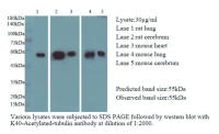 Anti K40-Acetylated-tubulin mouse monoclonal antibody