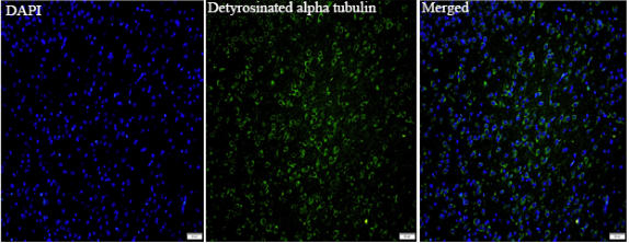 Anti Detyrosinated alpha tubulin mouse monoclonal antibody