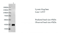 Anti GP73 mouse monoclonal antibody