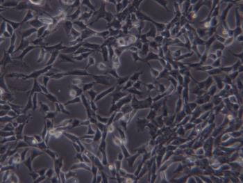 CHL-DMEM-2